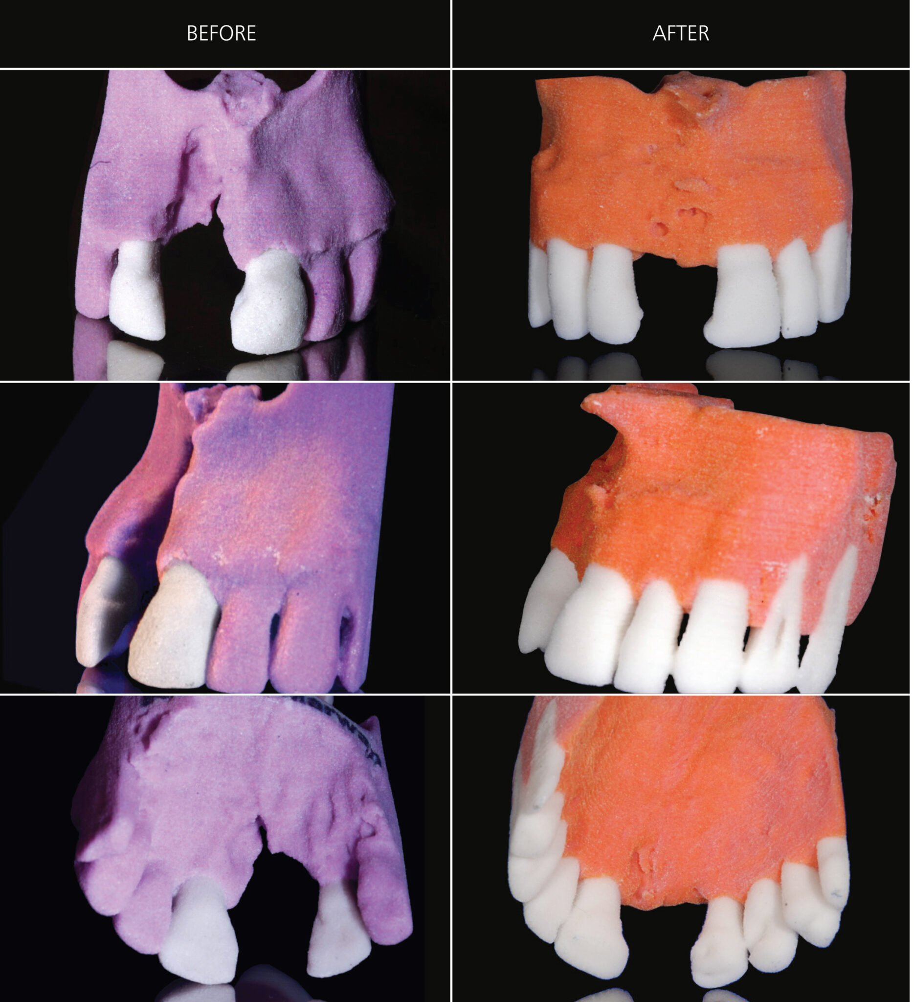 Bone Regeneration and Orthodontics Service Moira Wong Orthodontics