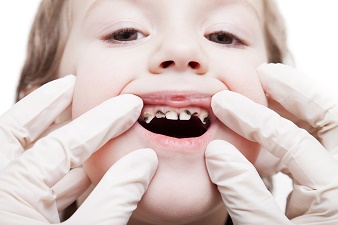 teeth, health, smile, dentist,dentalhealth, oralhealth