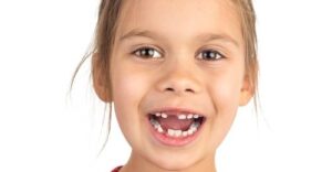 Why Only a Dentist Should Remove Children’s Loose Teeth