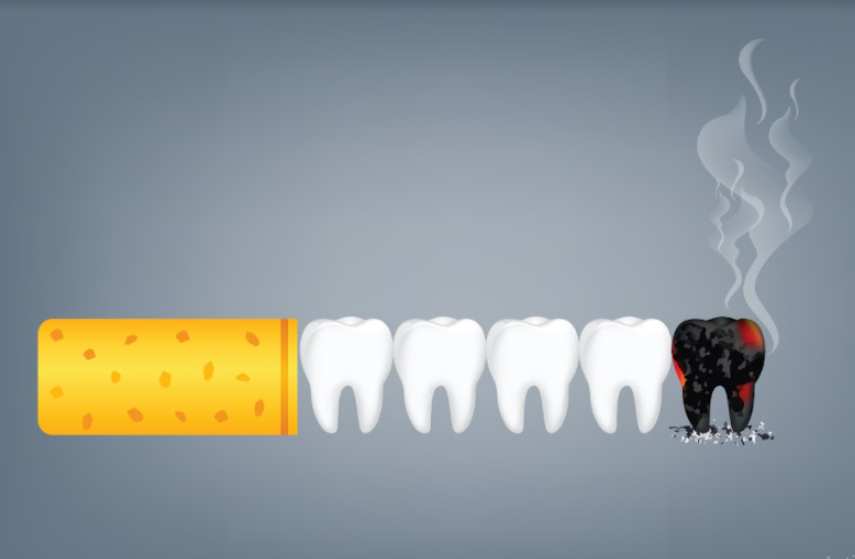 What Is the Impact of Smoking on Teeth and Gums?