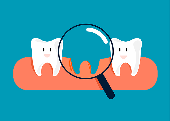 Three Ways To Prevent Tooth Loss
